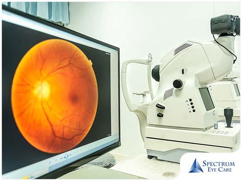 Eye Diseases That Can Be Caught Through Retinal Imaging Spectrum Eye Care