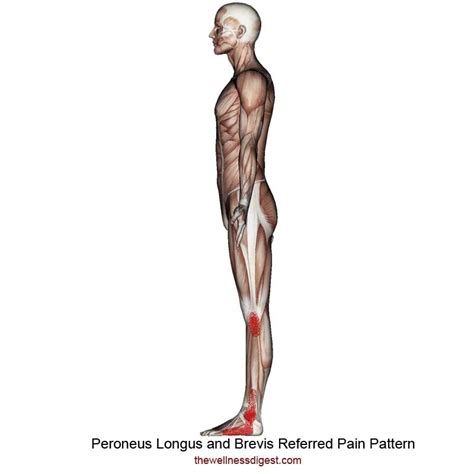 Peroneus Longus And Brevis Muscle Trigger Point Pain The Wellness Digest