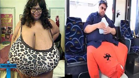 Top 10 People With Unusual Biggest Body Parts In The World