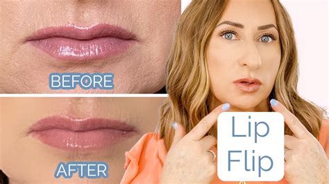 lip flip can you tell before and after {botox over 40} youtube
