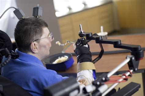 Braingate 2 Implants Allow Paralyzed Cleveland Veteran To Move Limb