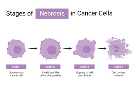 Stage Of Necrosis In Cancer Cells Biorender Science Templates