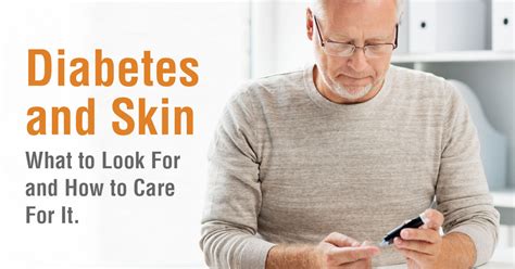 Diabetes And Skin What To Look For And How To Care For It Vitalfitsr