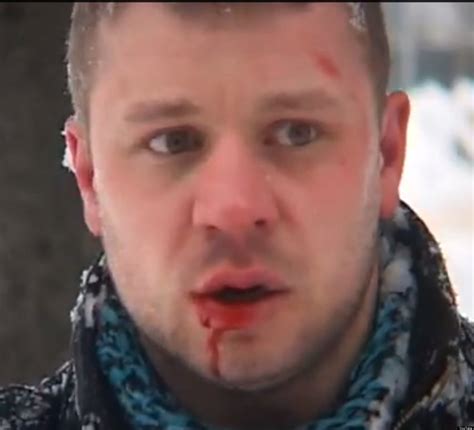 Artem Kalinin Russian Gay Activist Beaten By Local Neo Nazi On Camera