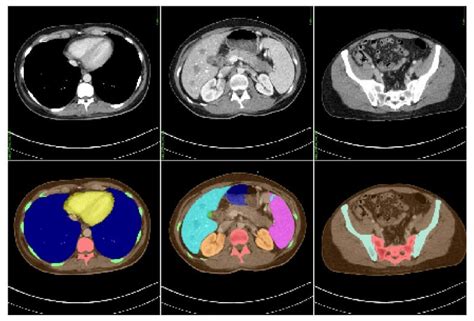 Ct Dose Calculations Can Be Both Quick And Accurate Physics World