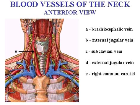 The hypoglossal nerve has been displaced downward in this preparation (lingual artery labeled at center left). Cervical Blood Vessels - Pain Neck