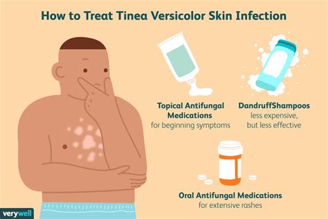Tinea Versicolor Treatments Whats Most Effective