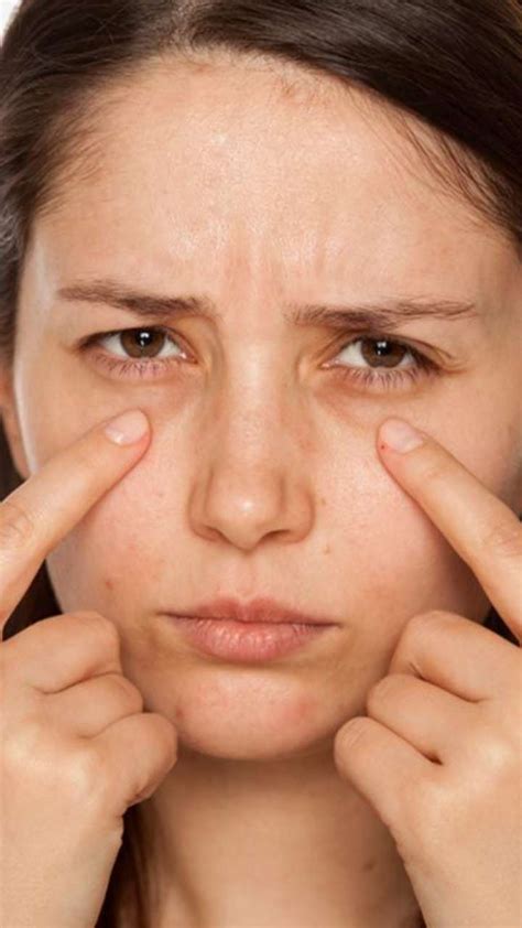 Top 7 Ways To Banish Under Eye Dark Circle And Puffiness