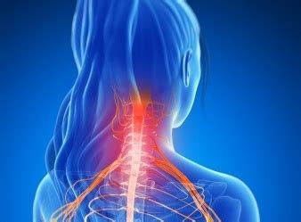 Tentu saja sakit kepala ini adalah penyakit sang sangat mengganggu berbagai aktivitas. Tips Mengatasi Nyeri Pada Leher | Tips Health For Life