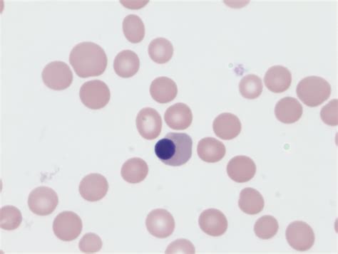 How Are Nucleated Rbcs Nrbcs Counted The Blood Project