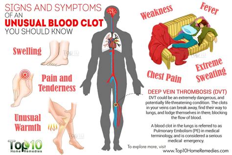 8 Early Warning Signs Of A Blood Clot To Never Ignore My007world