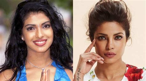 Priyanka Chopra Jonas Says She Didnt Open Up About Plastic Surgery In Her Book Unfinished