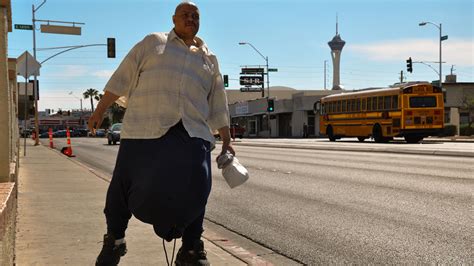 ‘the Man With The 132 Pound Scrotum Sparks Flurry Of Twitter Jokes