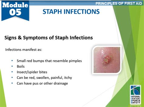 13 Staph Infections National Center For Sports Safety