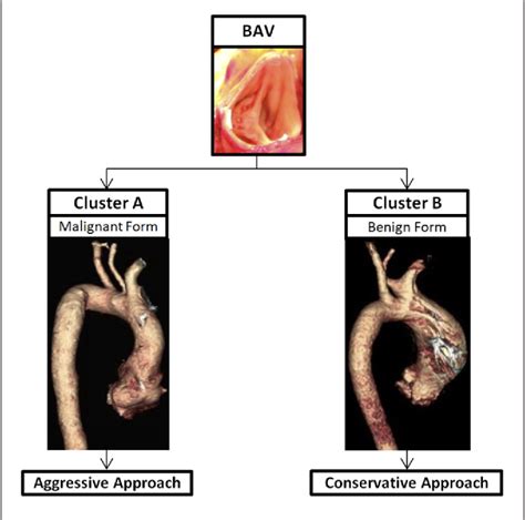 Figure 1 From Managing Thoracic Aortic Aneurysm In Patients With