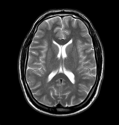 Brain Overview Philips Mr Body Map