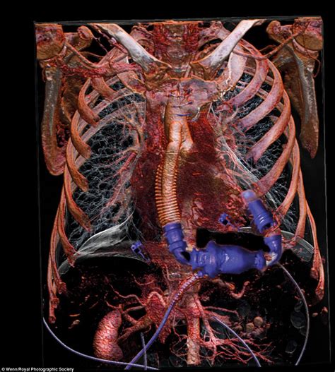 Mizzima is providing high quality news relating to myanmar while contributing toward freedom of expression and the realization of an inclusive and democratic myanmar for all the country's peoples. People and Places: Inside the body: images from world of ...