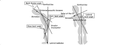 Schematic Representation Of Body Angles In Lateral View Photographs