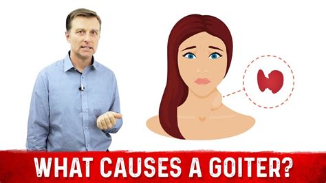 What Causes A Goiter Causes Of Thyroid Enlargement Drberg Youtube