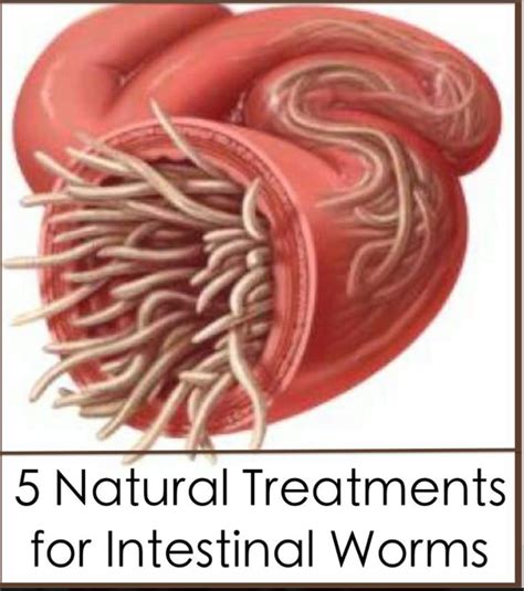 5 Natural Treatments For Intestinal Worms Parasite Cleanse Herbalism