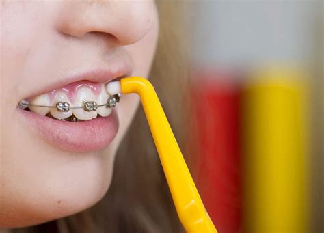 It is just important to floss with braces as it is to brush. Braces and Oral Hygiene: Keeping it Clean | Orthodontic ...