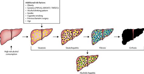 Outpatient Management Of Alcohol Related Liver Disease The Lancet Gastroenterology And Hepatology