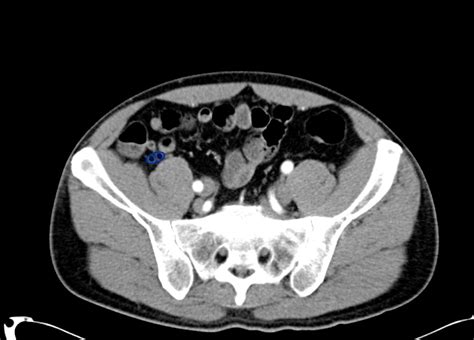 A Systematic Approach To The Interpretation Of Ct Abdomenpelvis