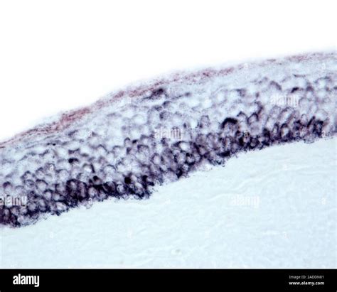 Light Micrograph Of Thin Skin Epidermis Stained With The Fontana Silver