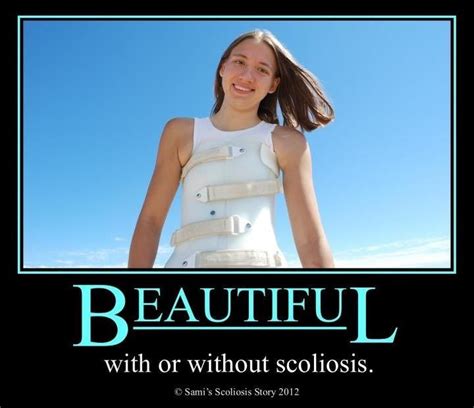 Scoliosis Brace Scoliosis Exercises Kids Braces Back Surgery Lower