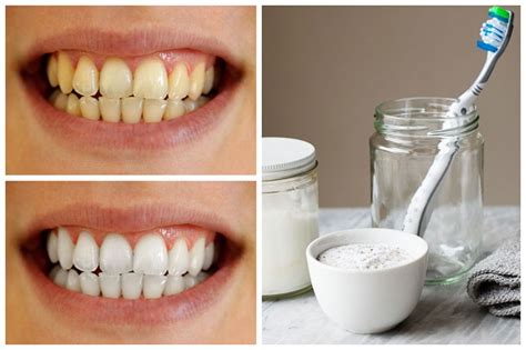 Homemade Teeth Whitening Paste That Really Works Best Herbal Health