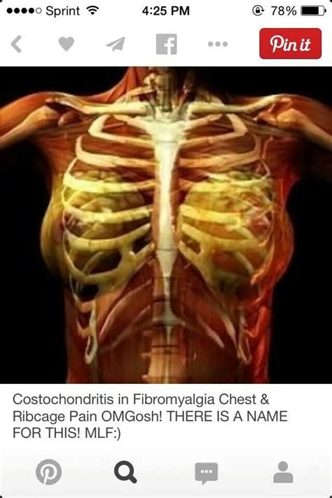 901 Best Images About Understanding Fibromyalgia On Pinterest