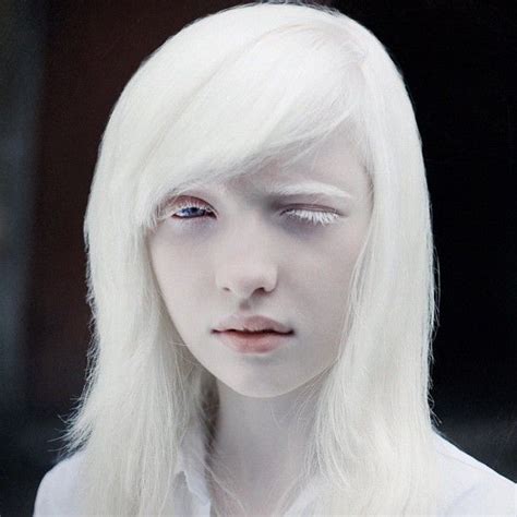 Albino Modelo Albino Shaun Ross Beautiful Models Beautiful People