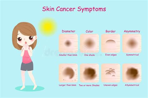 Woman With Skin Cancer Symptoms Stock Vector Illustration Of Cancer