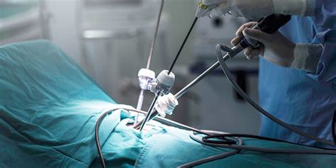 Laparoscopic Surgery For Uterovaginal Prolapsed Rl Memorial Hospital