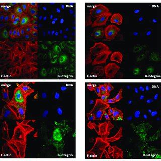 Microscopic visualization of F actin and integrin β1 in A549 cells