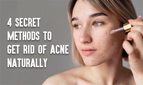 4 Secret Methods To Get Rid Of Acne Naturally Neostopzone