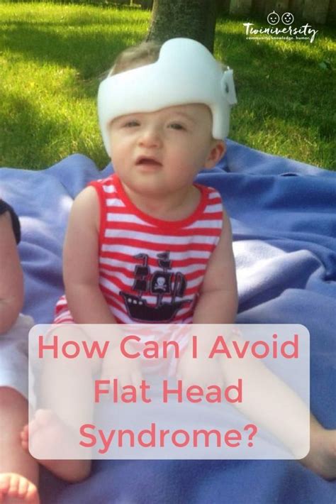 How Can I Avoid Flat Head Syndrome Flat Head Syndrome Syndrome