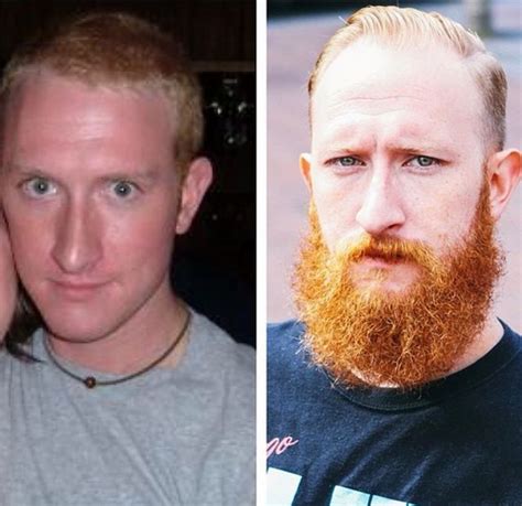 Men With And Without Beards 19 Pics