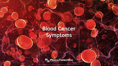 Blood Cancer Symptoms 10 Warning Signs Medical Trends Now