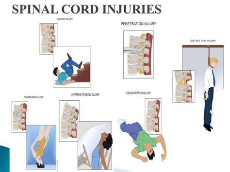 Evaluation Of Spinal Injury And Emergency Management
