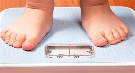 Oms Califica De Epidemia La Obesidad Infantil Noticias Uruguay