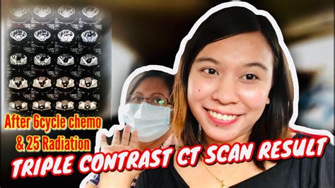 Triple Contrast Abdominal Ct Scan Result Ni Mama Good News Youtube