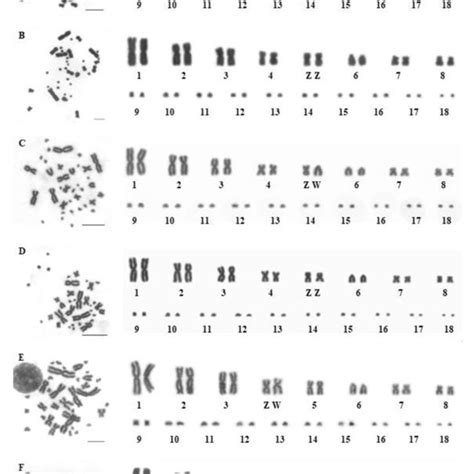 Metaphase Chromosomes And Karyotypes By Conventional Staining A A Download Scientific