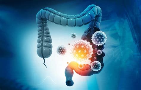 Gut Microbiome May Influence Covid 19 Severity And Immune Response