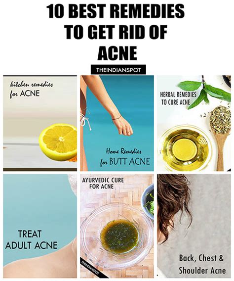 10 Best Home Remedies To Get Rid Of Acne