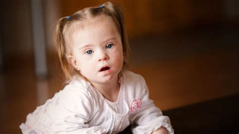 See more ideas about down syndrome, down syndrome kids, syndrome. These Adorable Pictures of Kids with Down Syndrome Prove ...