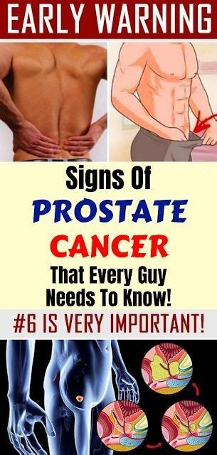 Early Warning Signs Of Prostate Cancer That Every Guy Needs To Know Healthy Lifestyle