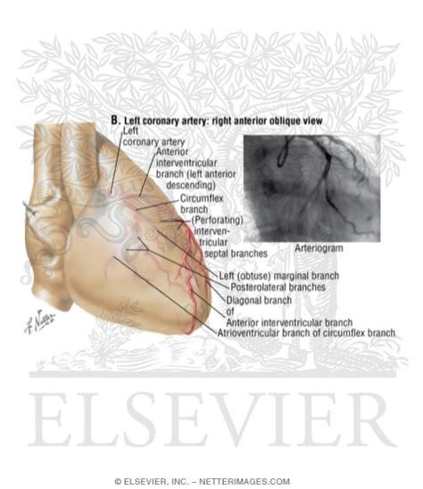 Left Coronary Artery Right Anterior Oblique View
