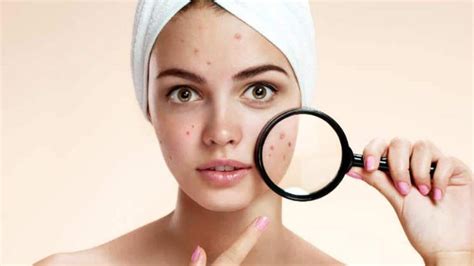 Home Remedies That Work To Remove Dark Spots On Face Newsbytes