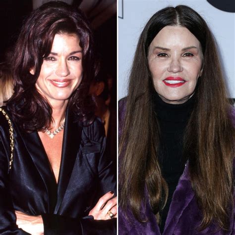 Inside Janice Dickinsons Plastic Surgery Transformation See The Model